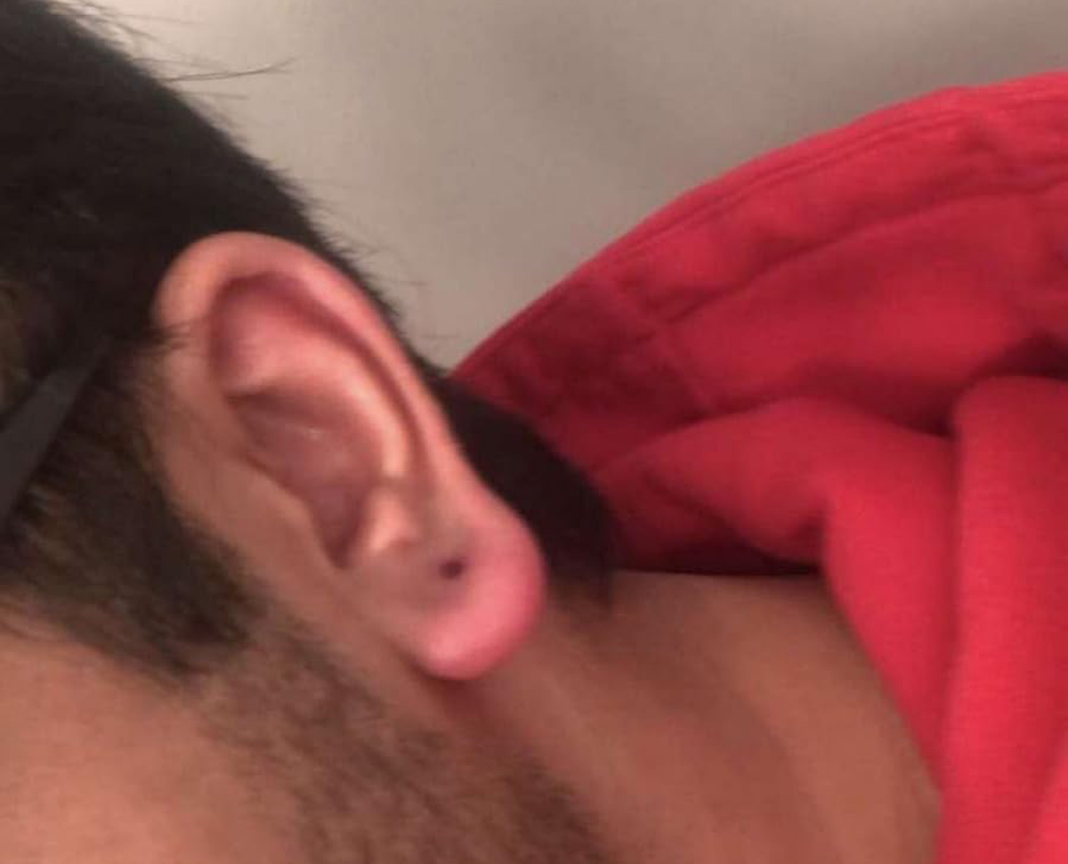 ear piercing infected